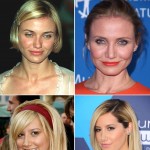 私たち、なおしました！整形を認めたセレブ