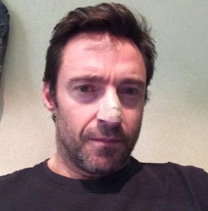 皮膚ガンを診断されたことを公表（※ヒュー・ジャックマンのインスタグラムより）