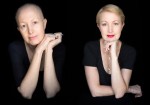 ガンと闘う女性たちのポートレートを撮影　写真家が語る思い