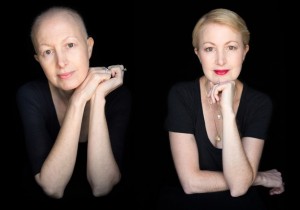 ガンと闘う女性たちのポートレートを撮影　写真家が語る思い