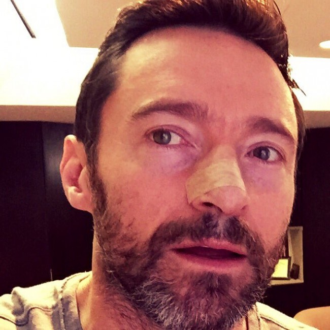 ヒュー・ジャックマン、Hugh Jackman