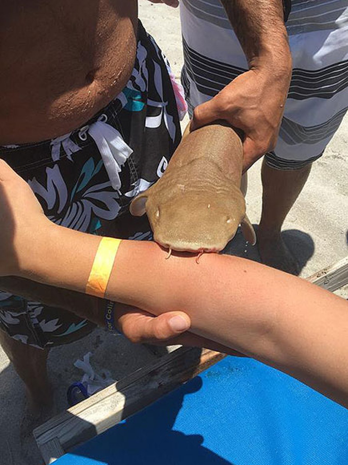 子ザメが女性の腕に噛み付いた！実際の写真