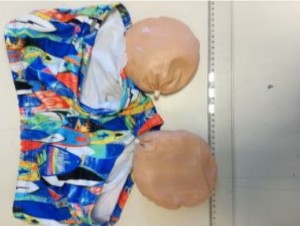 お尻のインプラントからコカイン発見で逮捕！