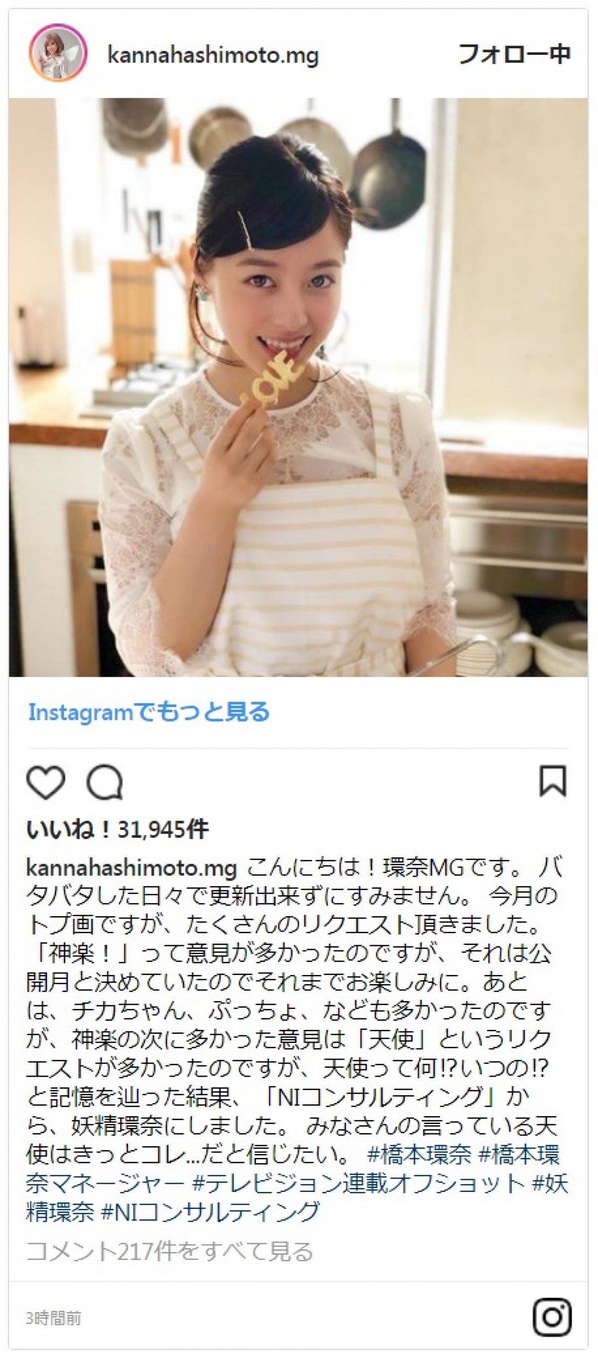 橋本環奈「産毛ちゃんです」 デコ出しショットに「いいね！」殺到