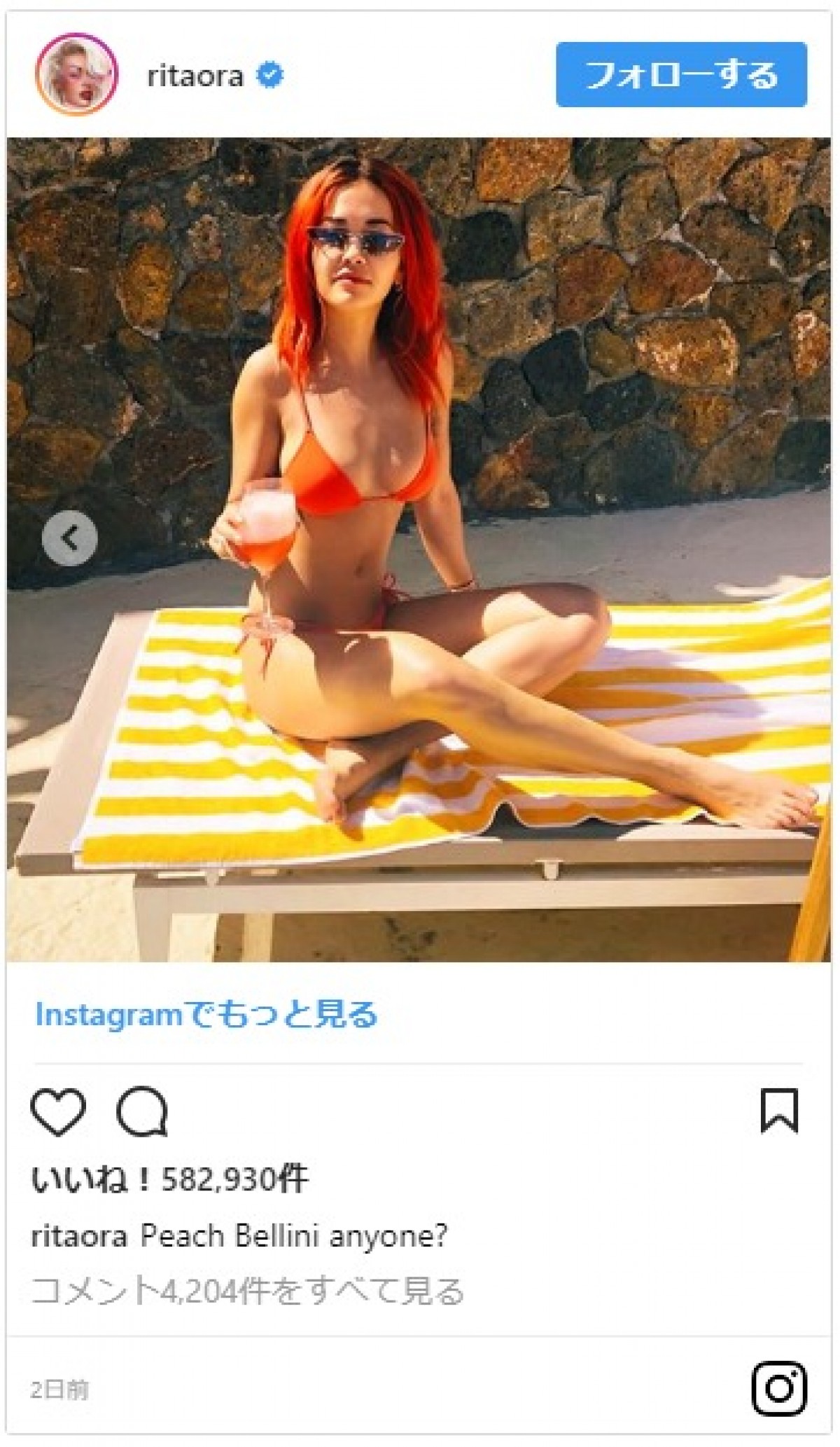 リタ・オラ、まばゆいビキニショット披露　ファン「そのボディは目標」