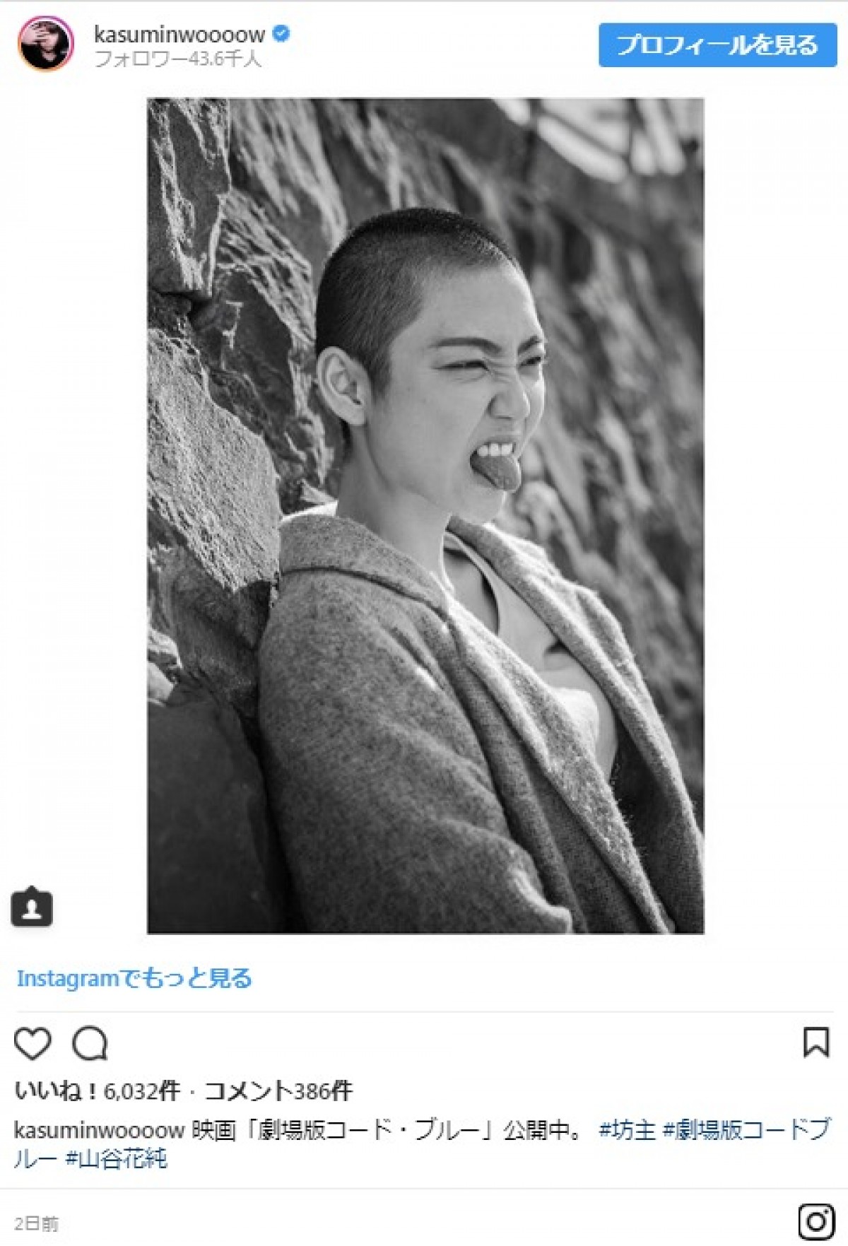 『コード・ブルー』山谷花純が“丸刈り姿”公開　引退覚悟した思い語る