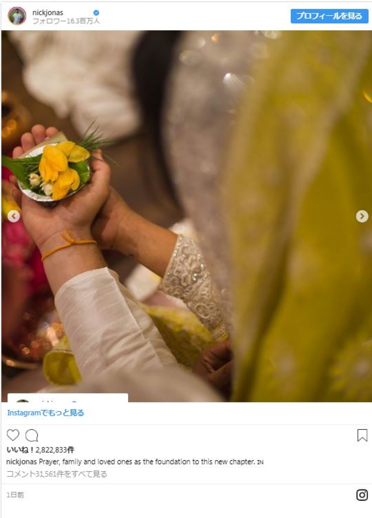 ニック・ジョナス、「未来のジョナス夫人」との婚約セレモニー写真公開