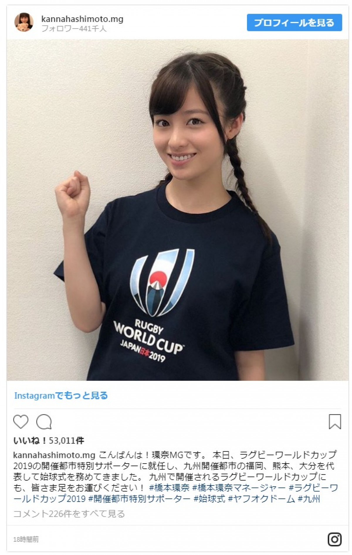 橋本環奈「産毛ちゃんです」 デコ出しショットに「いいね！」殺到
