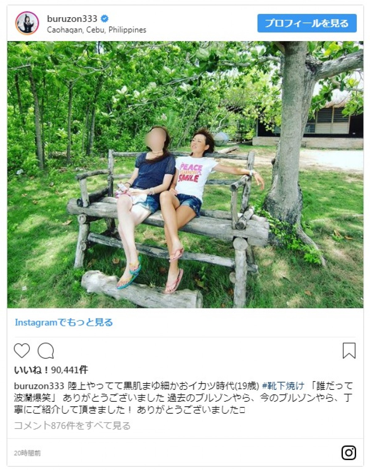 ブルゾンちえみ、セクシーな美脚を披露　10代の写真にファンびっくり