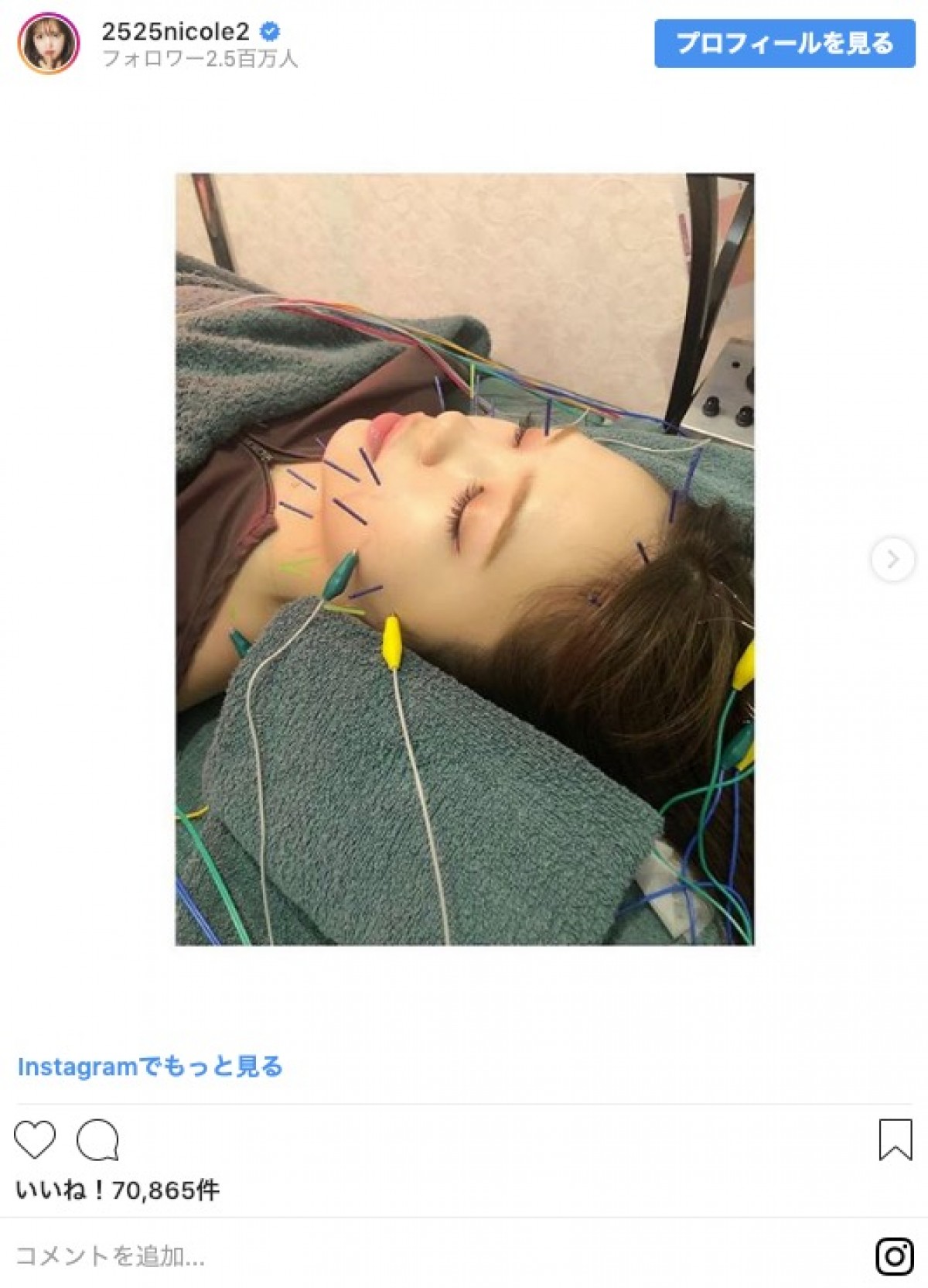 藤田ニコル「ほうれい線が私の永遠の悩み」 美への努力に称賛の声