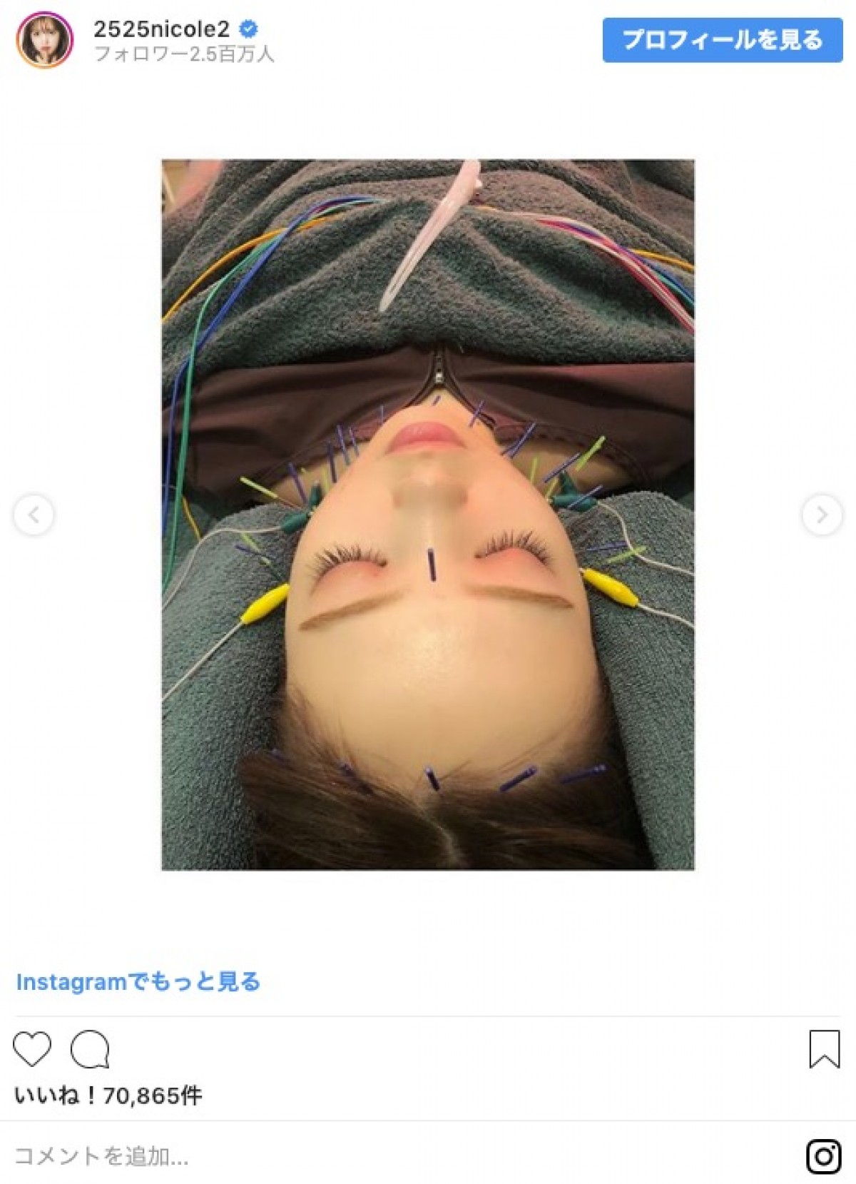 藤田ニコル「ほうれい線が私の永遠の悩み」 美への努力に称賛の声