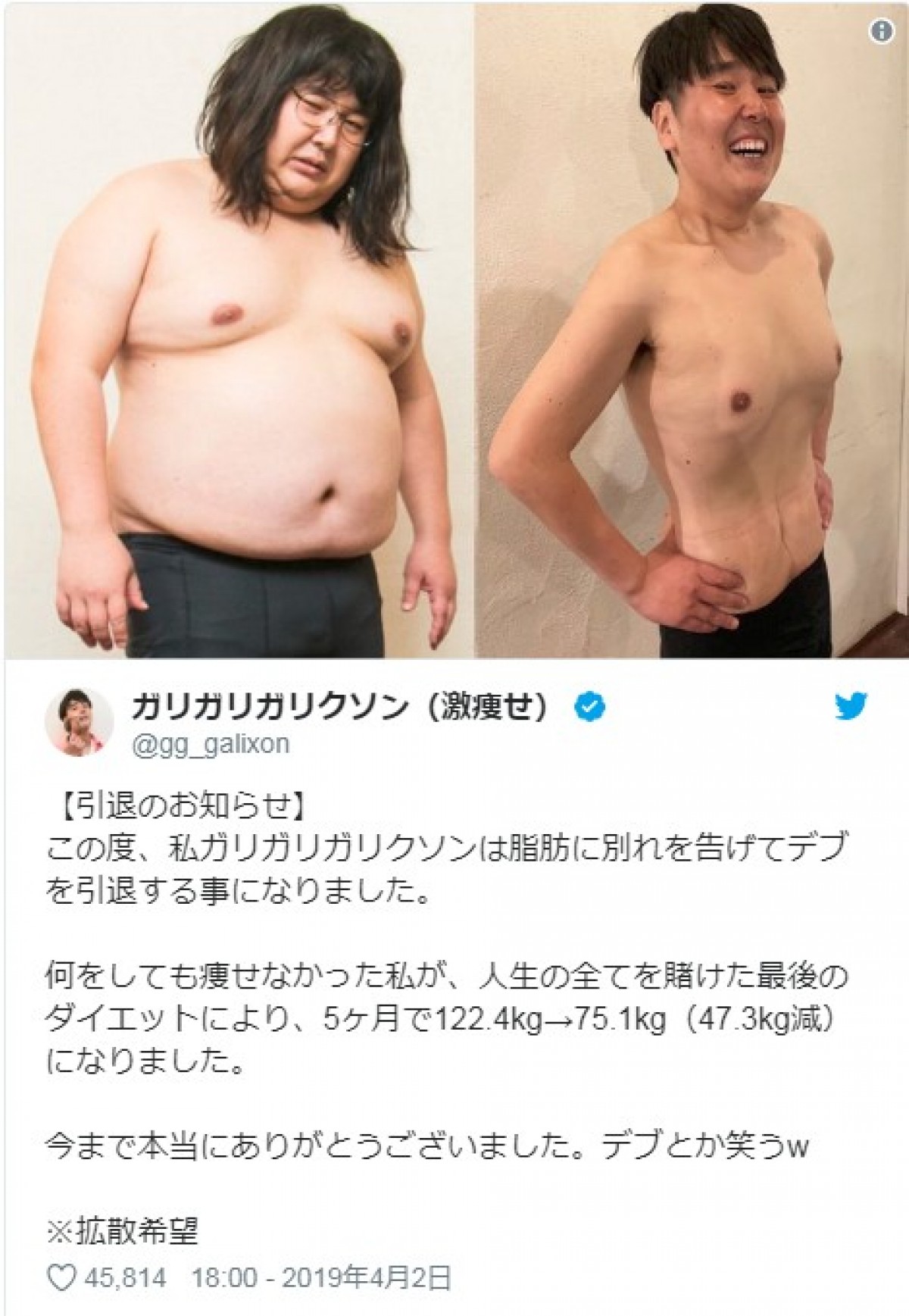 ガリガリガリクソン、約50kg減量に驚きの声が殺到「電話とかLINEが鳴り止まない」