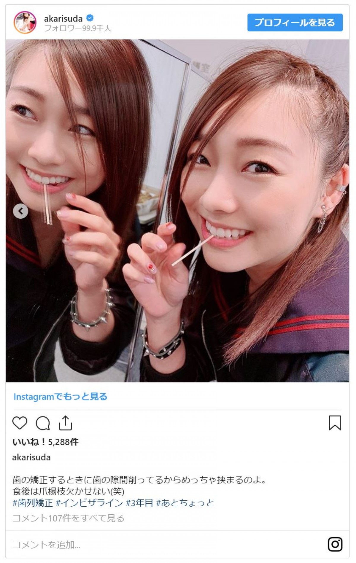 SKE48須田亜香里、“ヤンキーミニスカ制服姿” 「美脚」と評判