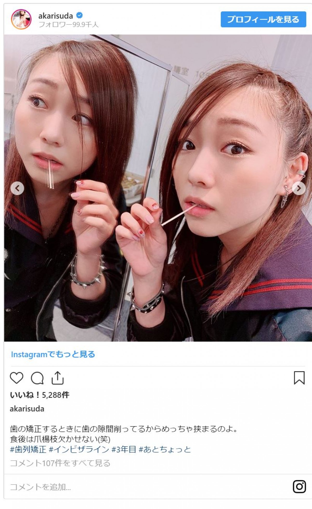 SKE48須田亜香里、“ヤンキーミニスカ制服姿” 「美脚」と評判