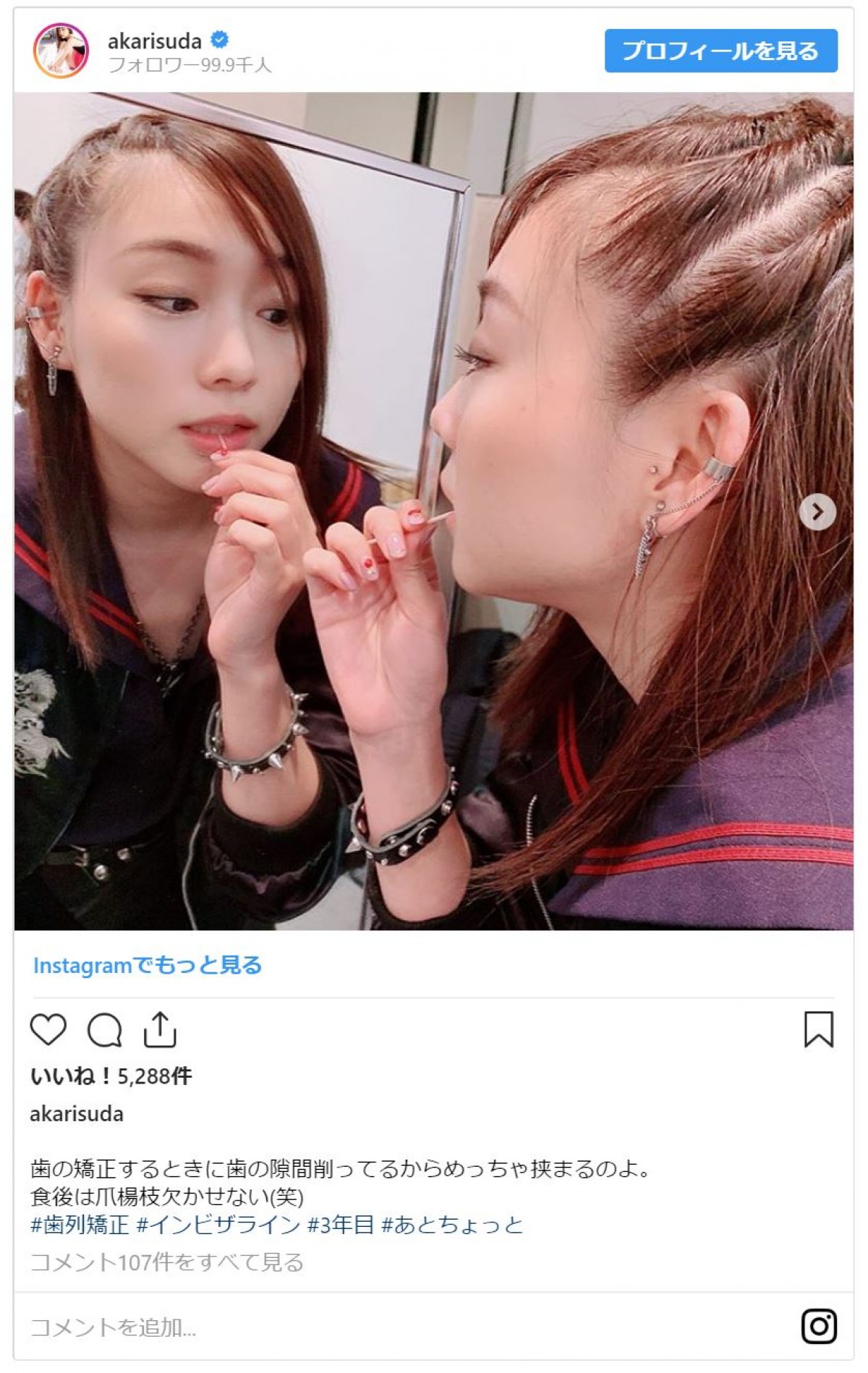SKE48須田亜香里、“ヤンキーミニスカ制服姿” 「美脚」と評判