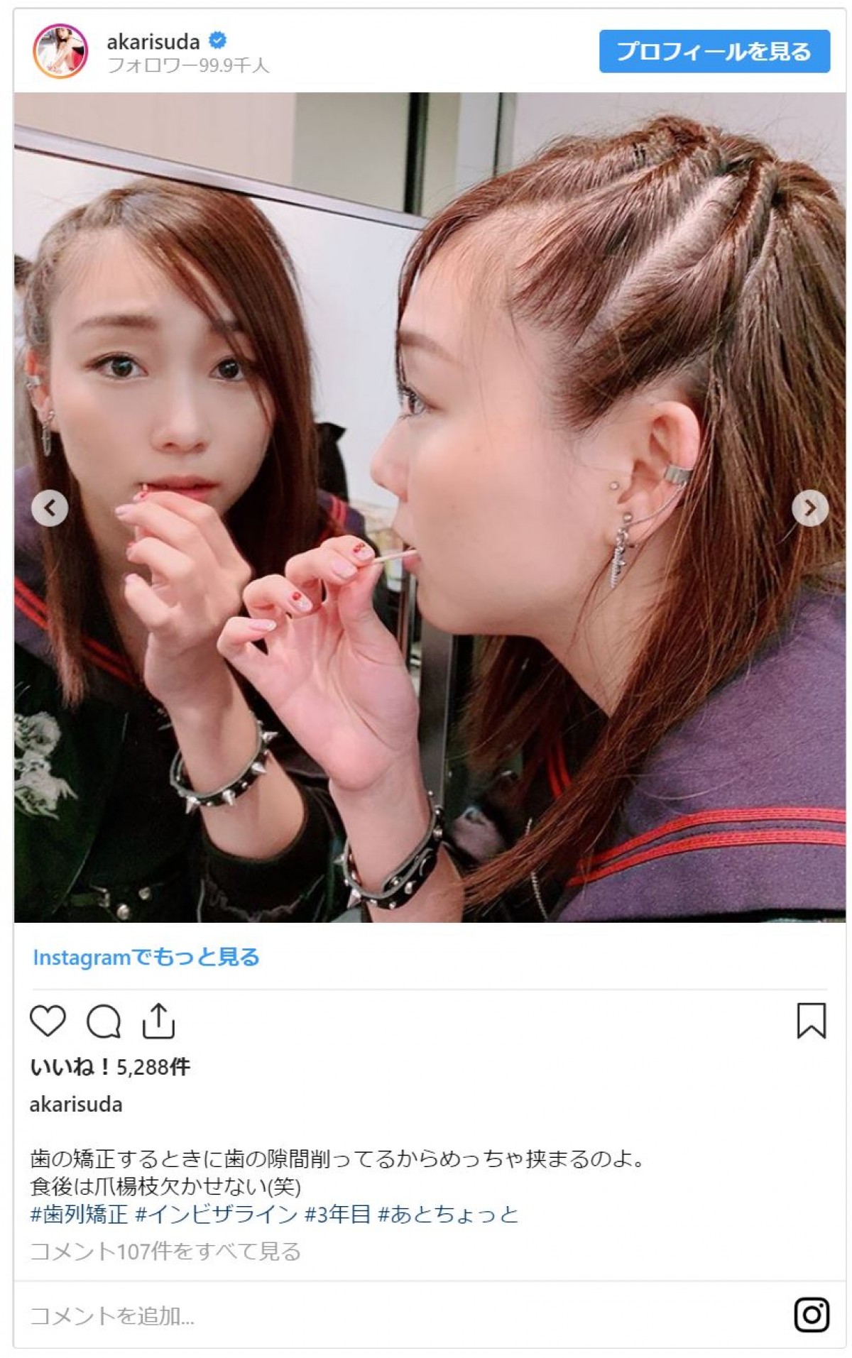 SKE48須田亜香里、“ヤンキーミニスカ制服姿” 「美脚」と評判