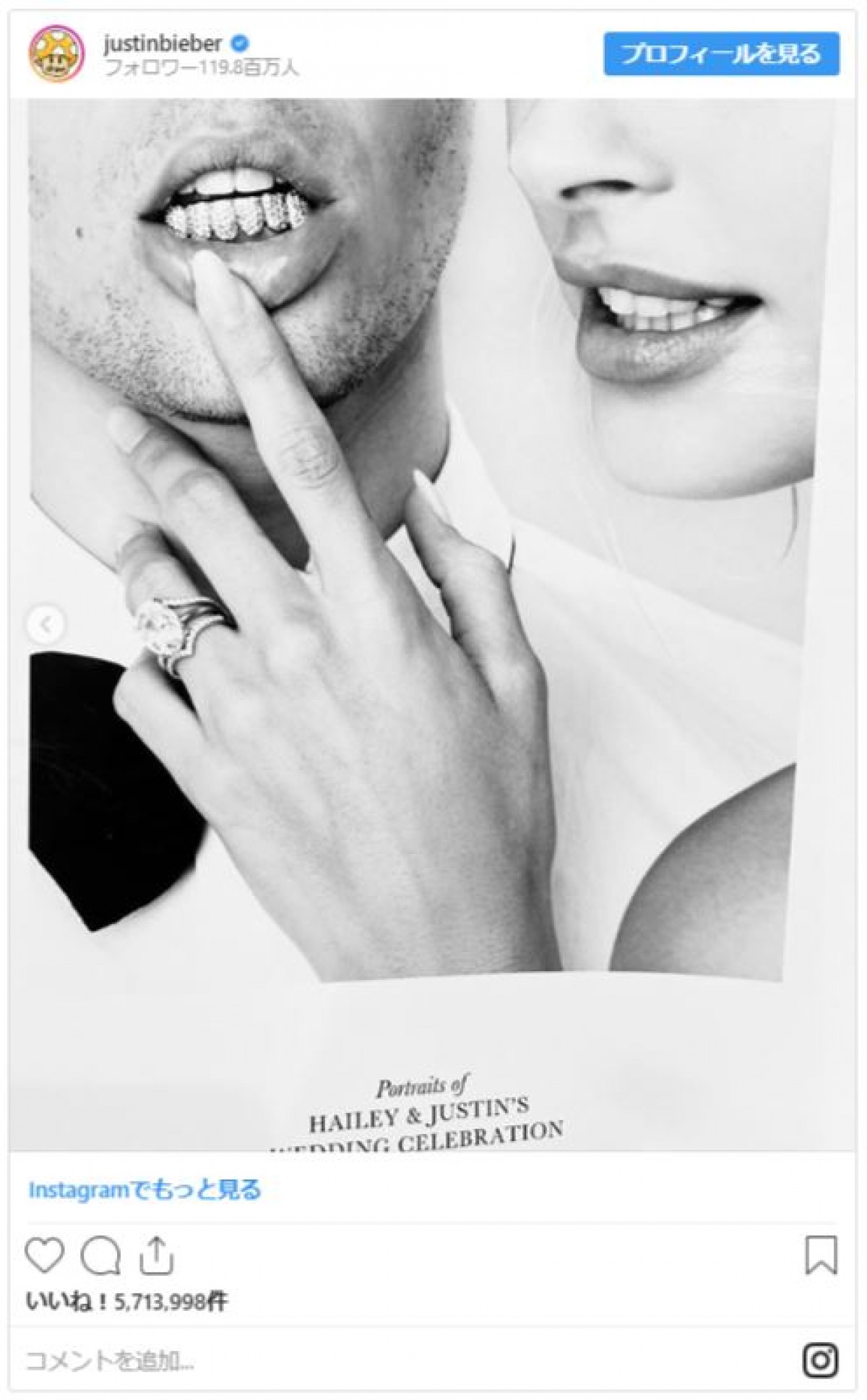 ジャスティン＆ヘイリー・ビーバー夫妻、キュートなキス写真公開