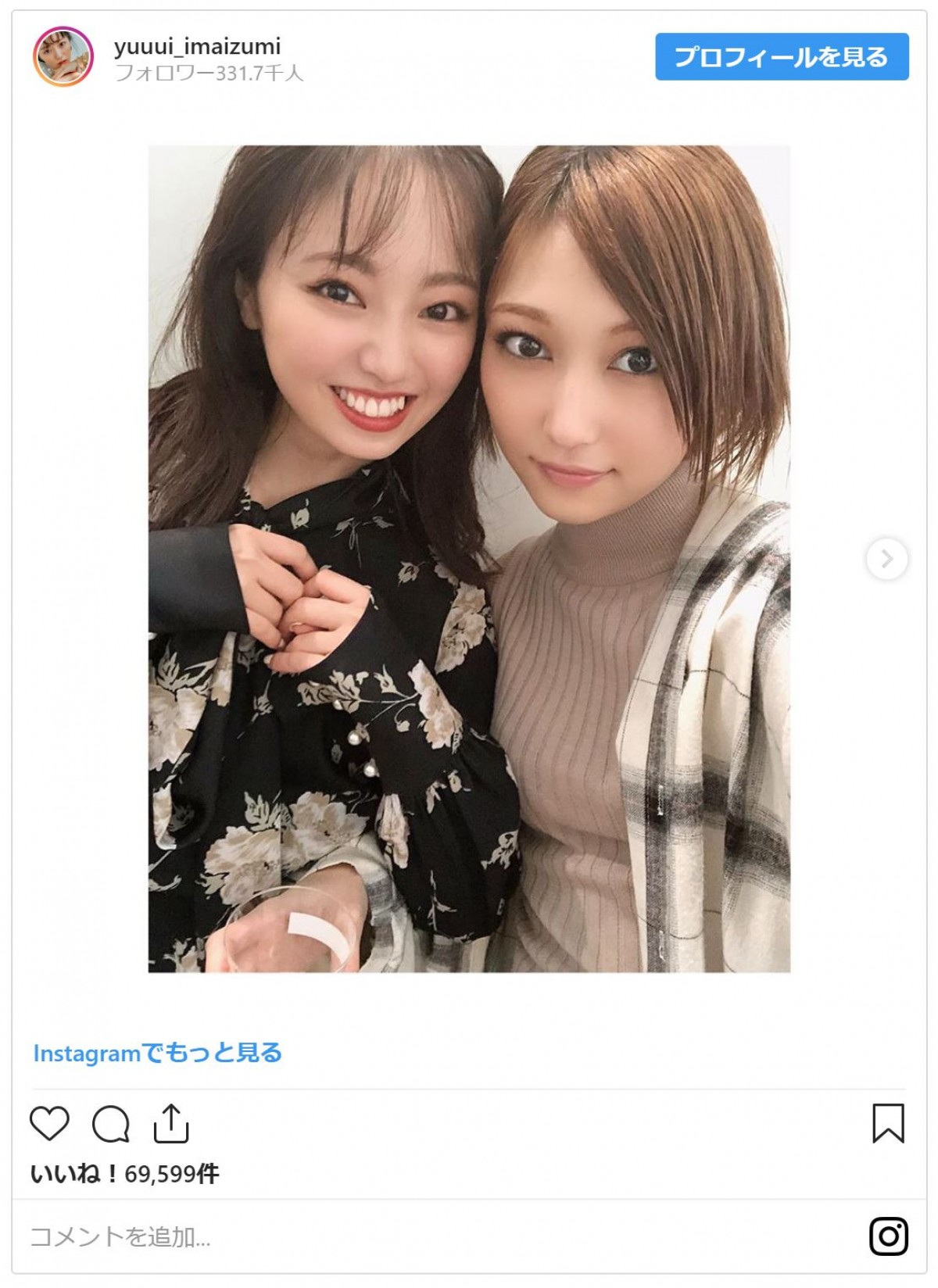 元欅坂46・今泉佑唯＆志田愛佳の顔寄せ2ショットに「可愛い！」「圧倒的美貌」