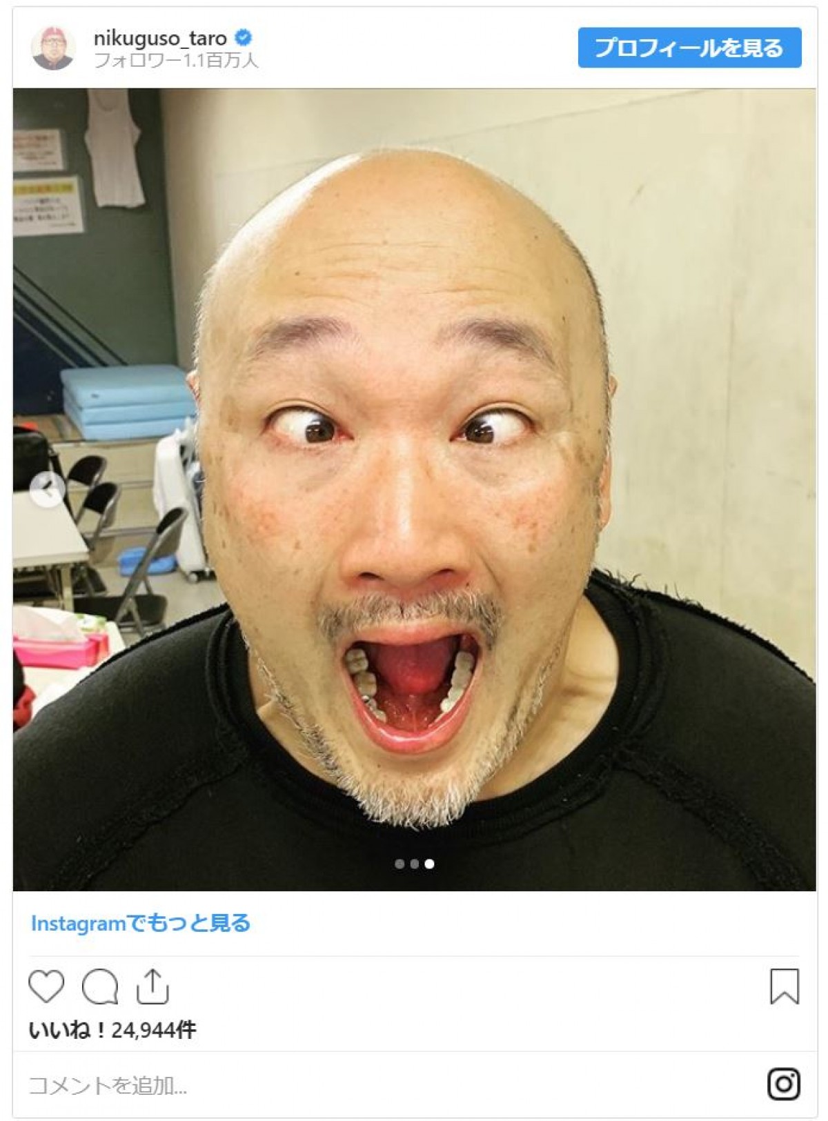 クロちゃん、錦鯉・長谷川らスキンヘッド芸人の“フサフサ”時代「普通に男前やん」「めちゃタイプ」