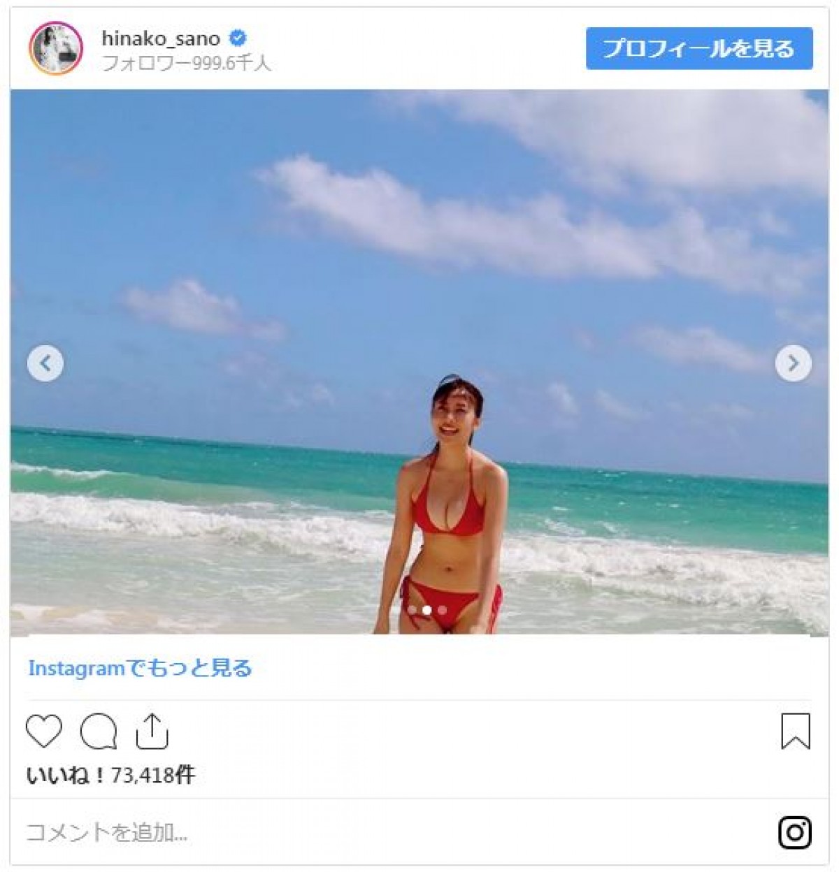佐野ひなこ、黒ビキニでスマイル！ 写真集アザーカットにファン「奇跡のカラダ」