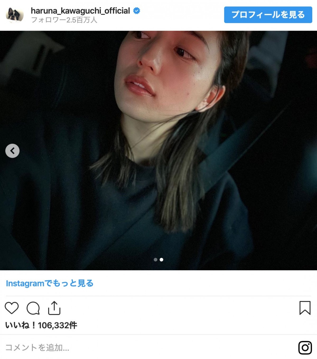 川口春奈「ニキビがいてぇ！ 肌荒れつらい、、、」 人気女優の“素の表情”に反響