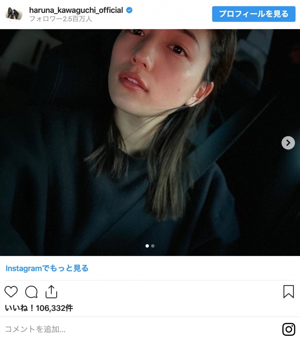 川口春奈「ニキビがいてぇ！ 肌荒れつらい、、、」 人気女優の“素の表情”に反響