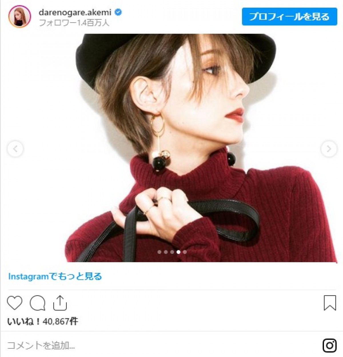 ダレノガレ明美、ショートボブ時代の写真に反響「めちゃくちゃ可愛い」