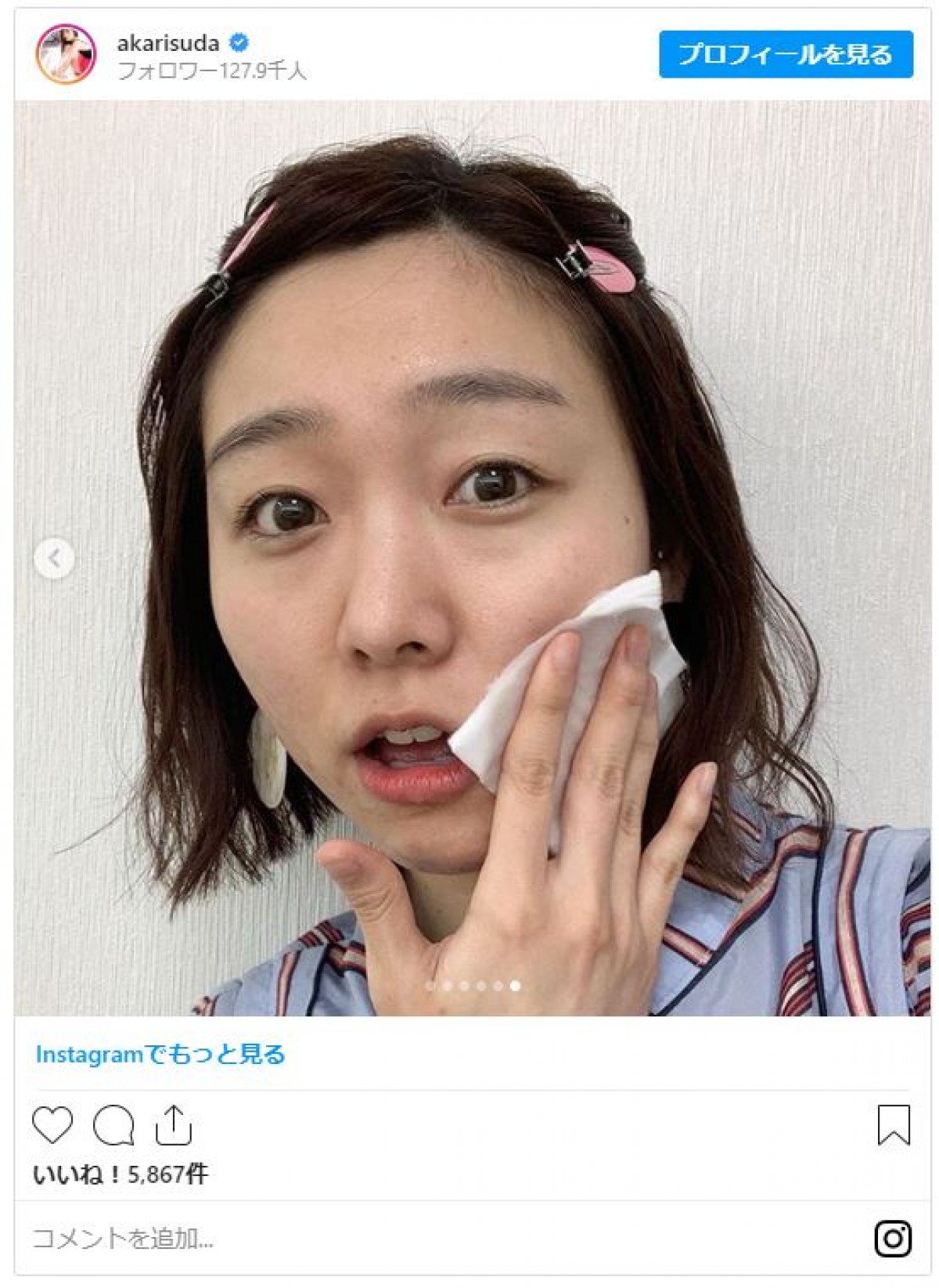 須田亜香里、“無加工すっぴん”写真　ナチュラルな美肌に「かわいい」と反響