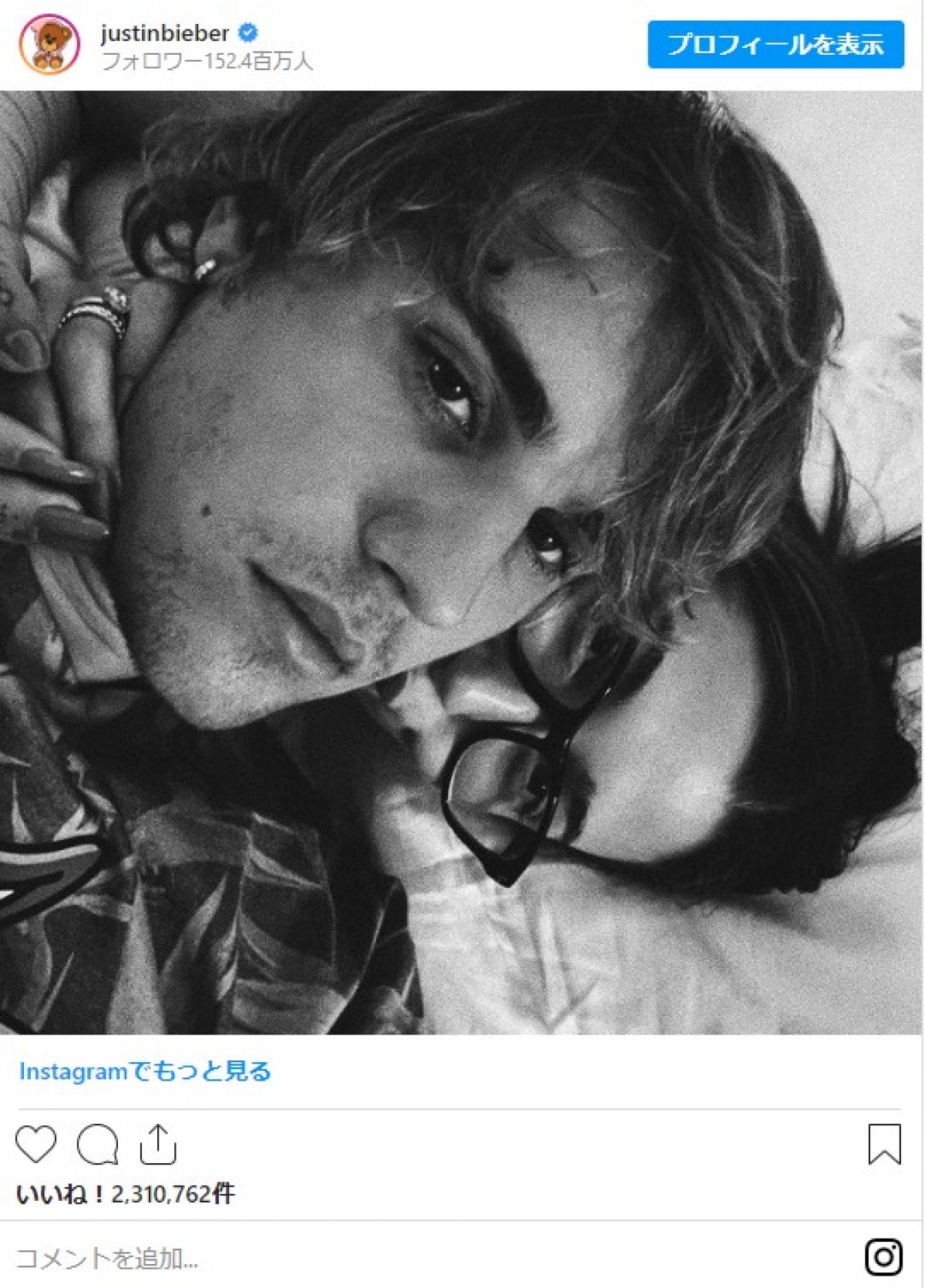 ジャスティン＆ヘイリー・ビーバー、バックハグの密着ラブラブ写真公開 