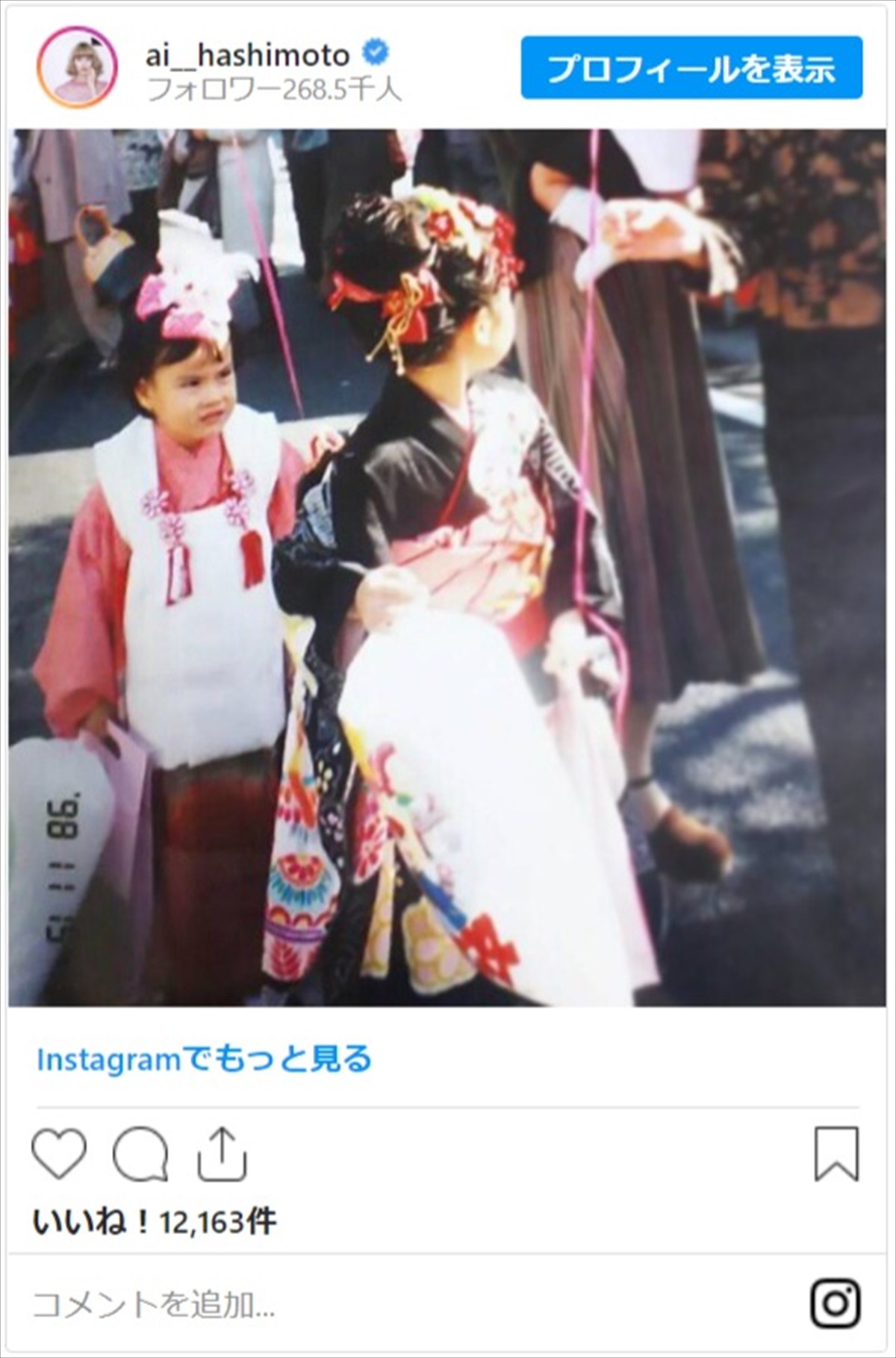 橋本愛「こいつ女の子って本当？」 険しい顔の幼少期ショットにネット「強そう」