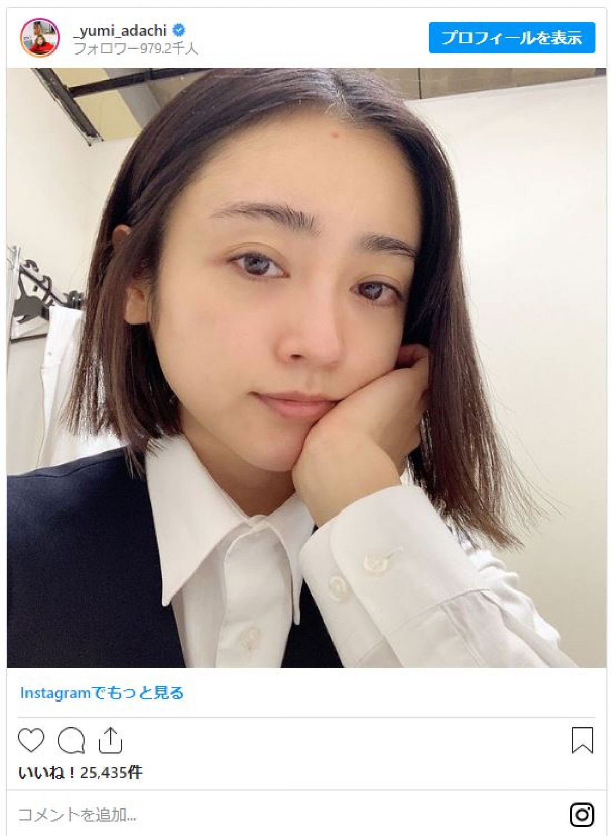 安達祐実「おでこにBIGなニキビ出来てる」 飾らないインスタに反響