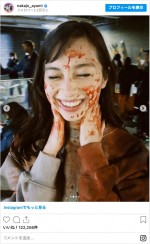 血だらけ！　※「中条あやみ」インスタグラム