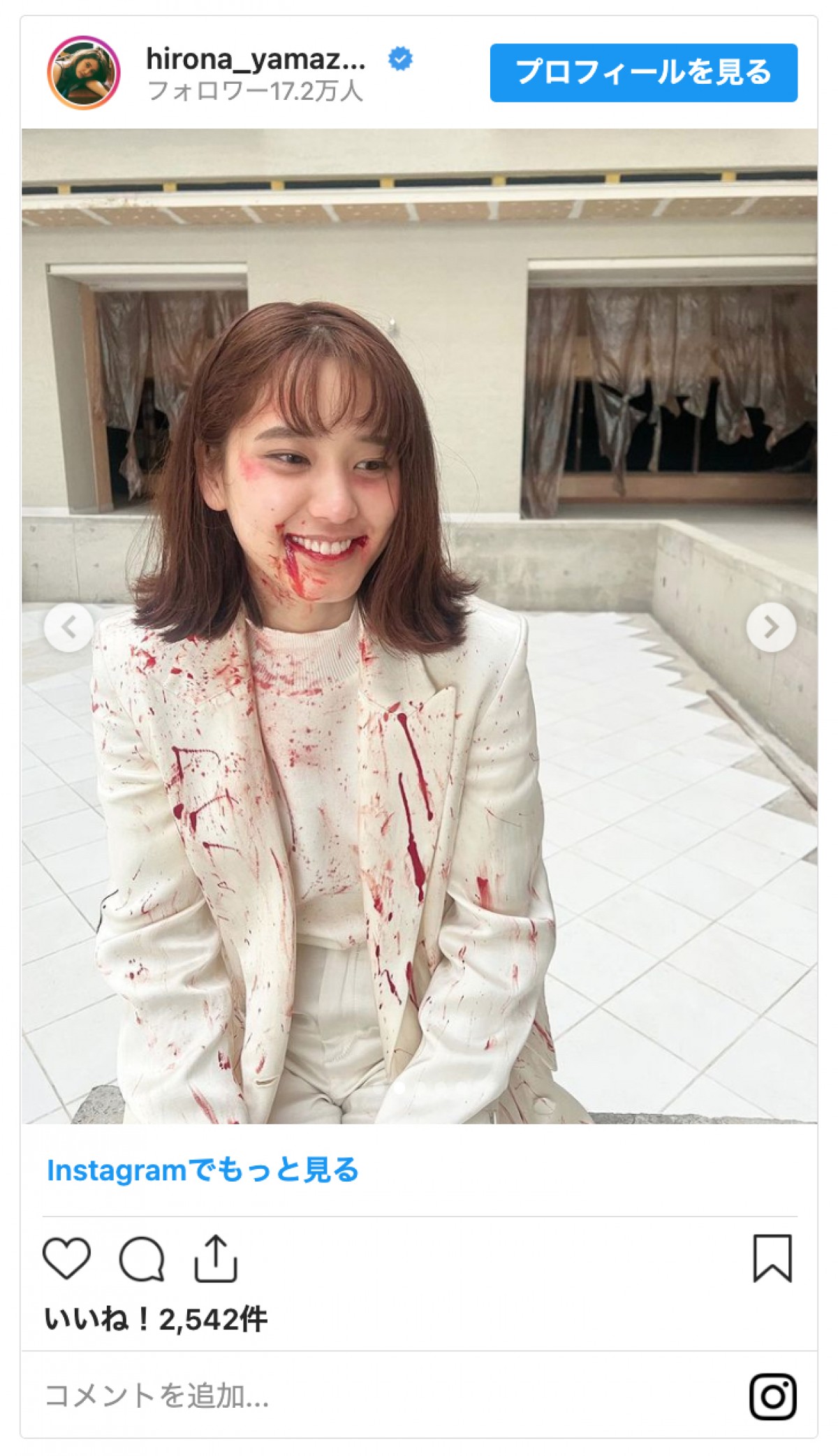 山崎紘菜「たくさんなぐられた。ぴえん」“血まみれ”の姿にファン驚き「ぎゃあああ」「こわっ」