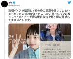 【写真】あの、バイクで転倒　顔の骨を骨折「顔パンパンになっちゃった」　驚きと心配の声が殺到
