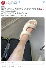 きゃりーぱみゅぱみゅ、”痛々しい”海でのケガの経過報告　※「きゃりーぱみゅぱみゅ」ツイッター