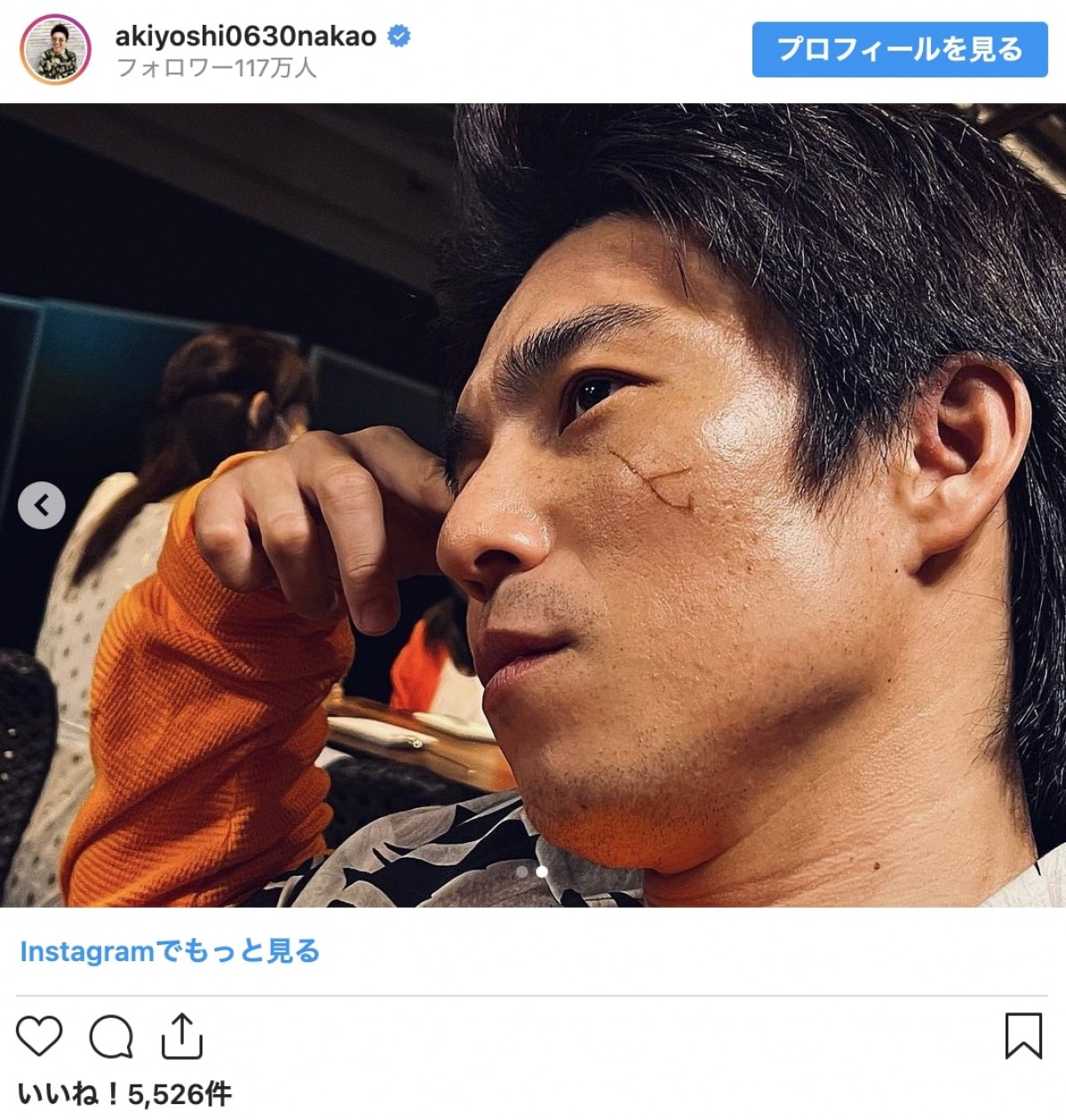 中尾明慶、竹内涼真撮影のドアップショット　「輪郭はブラピで横顔はトムクルーズです」