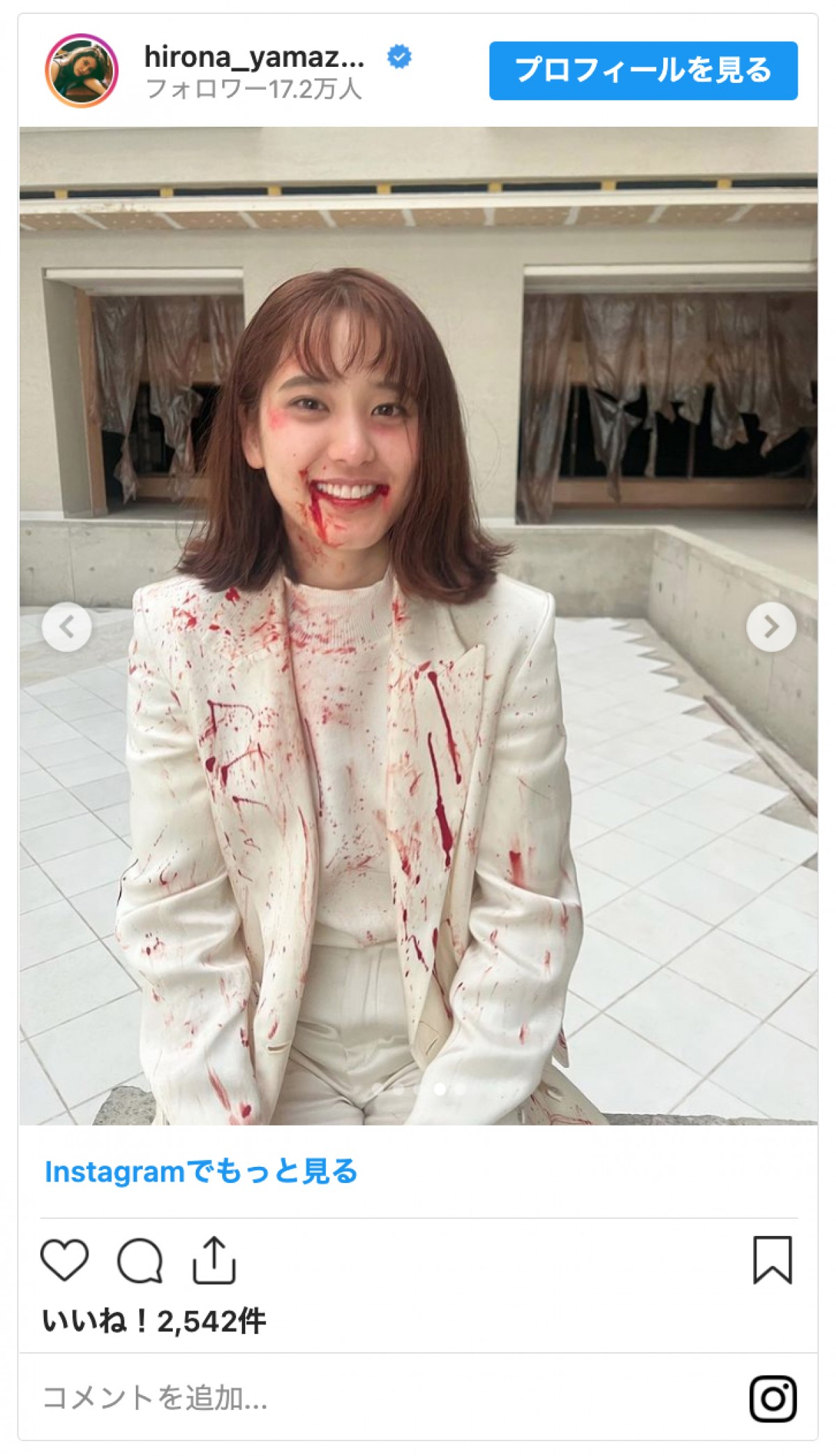 山崎紘菜「たくさんなぐられた。ぴえん」“血まみれ”の姿にファン驚き「ぎゃあああ」「こわっ」