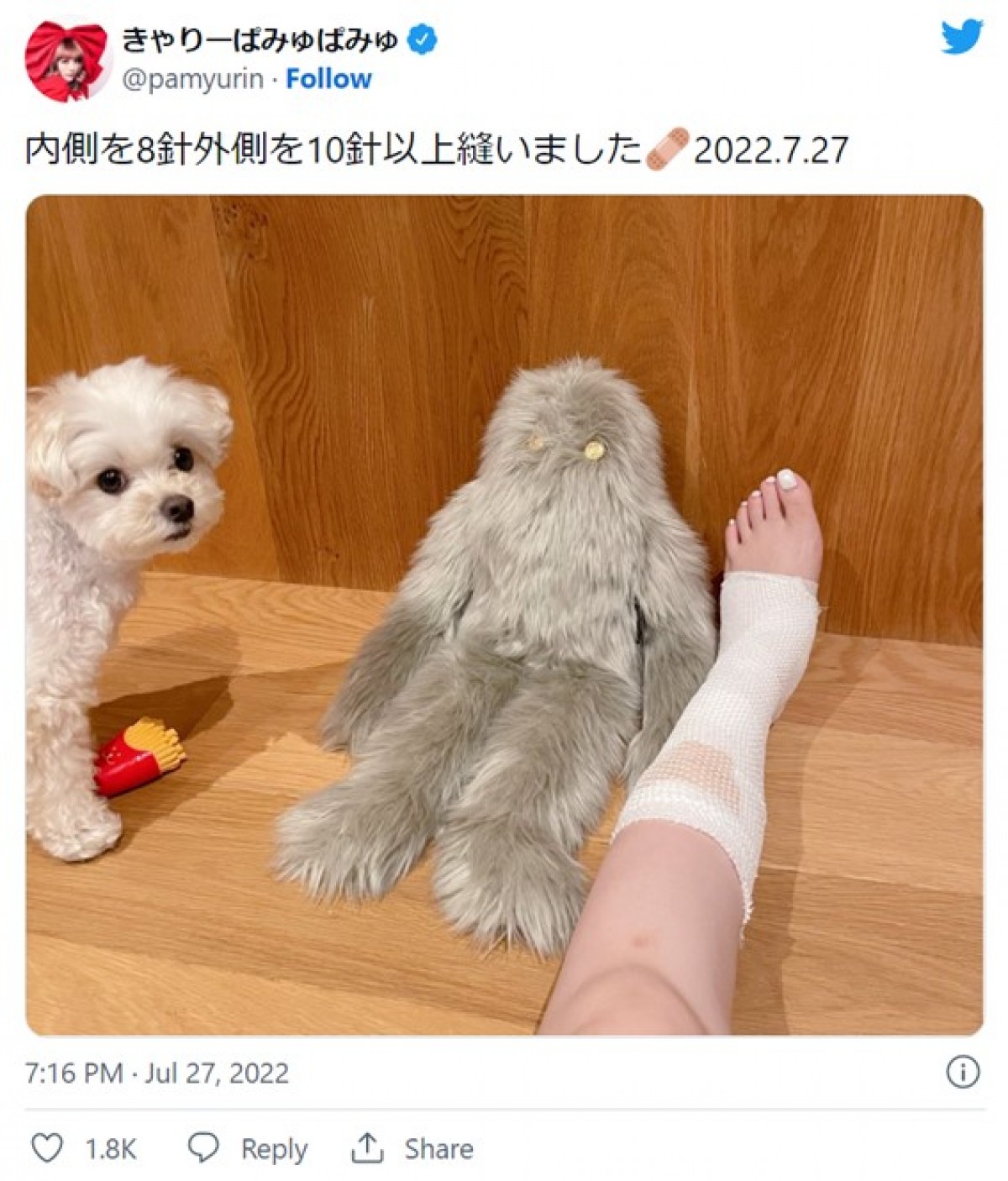 きゃりーぱみゅぱみゅ、海で大ケガ「内側を8針外側を10針以上縫いました」
