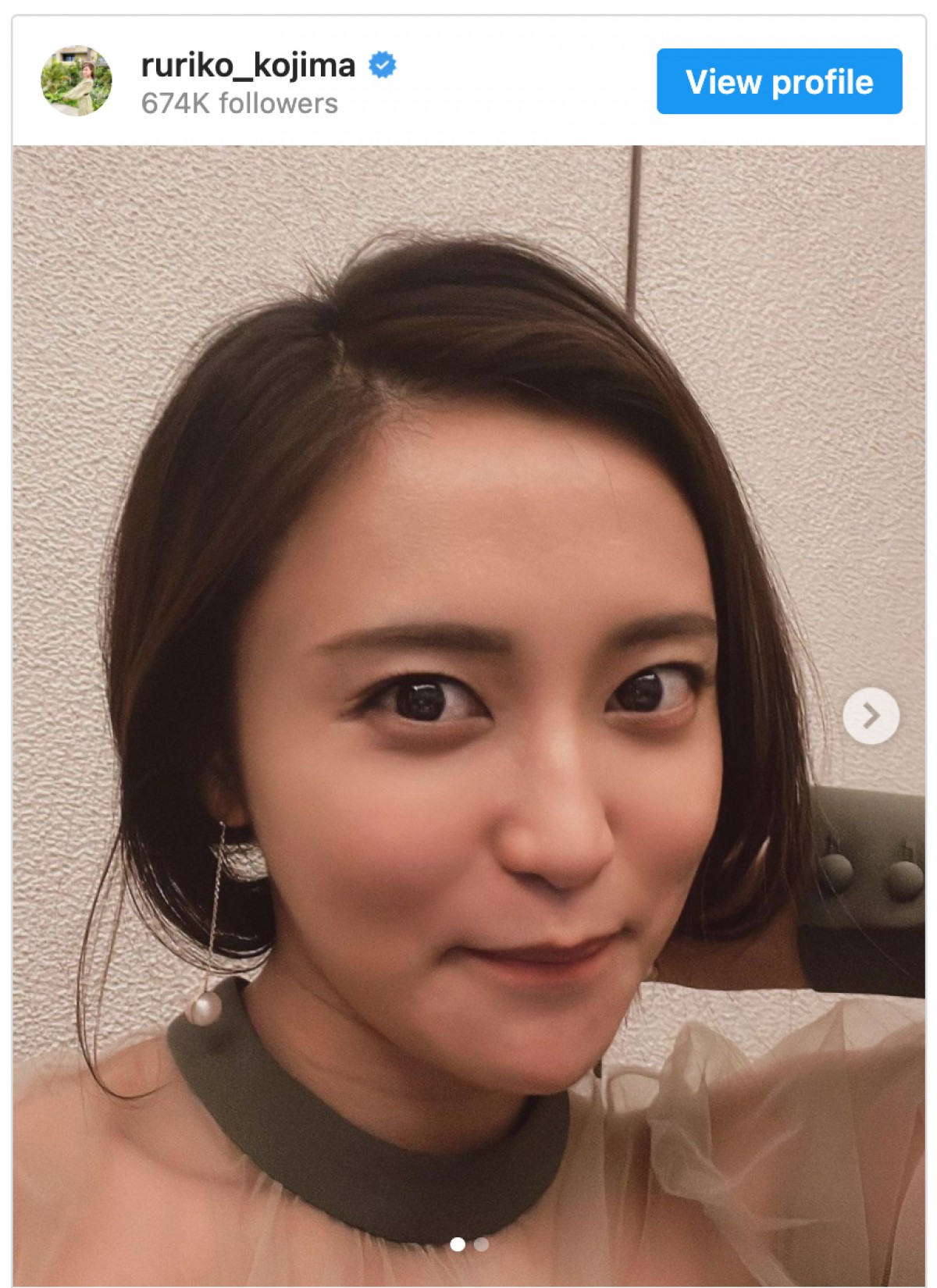 小島瑠璃子、“ショートヘア”or“ロングヘア”で悩み中　指原莉乃も「迷う」