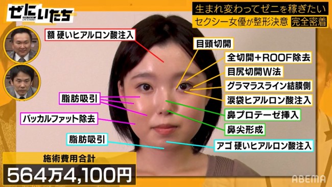 (写真)総額560万円の美容整形ビフォーアフターにかまいたち感動「これはすごいよ」 - エンタメ - ニュース |クランクイン!