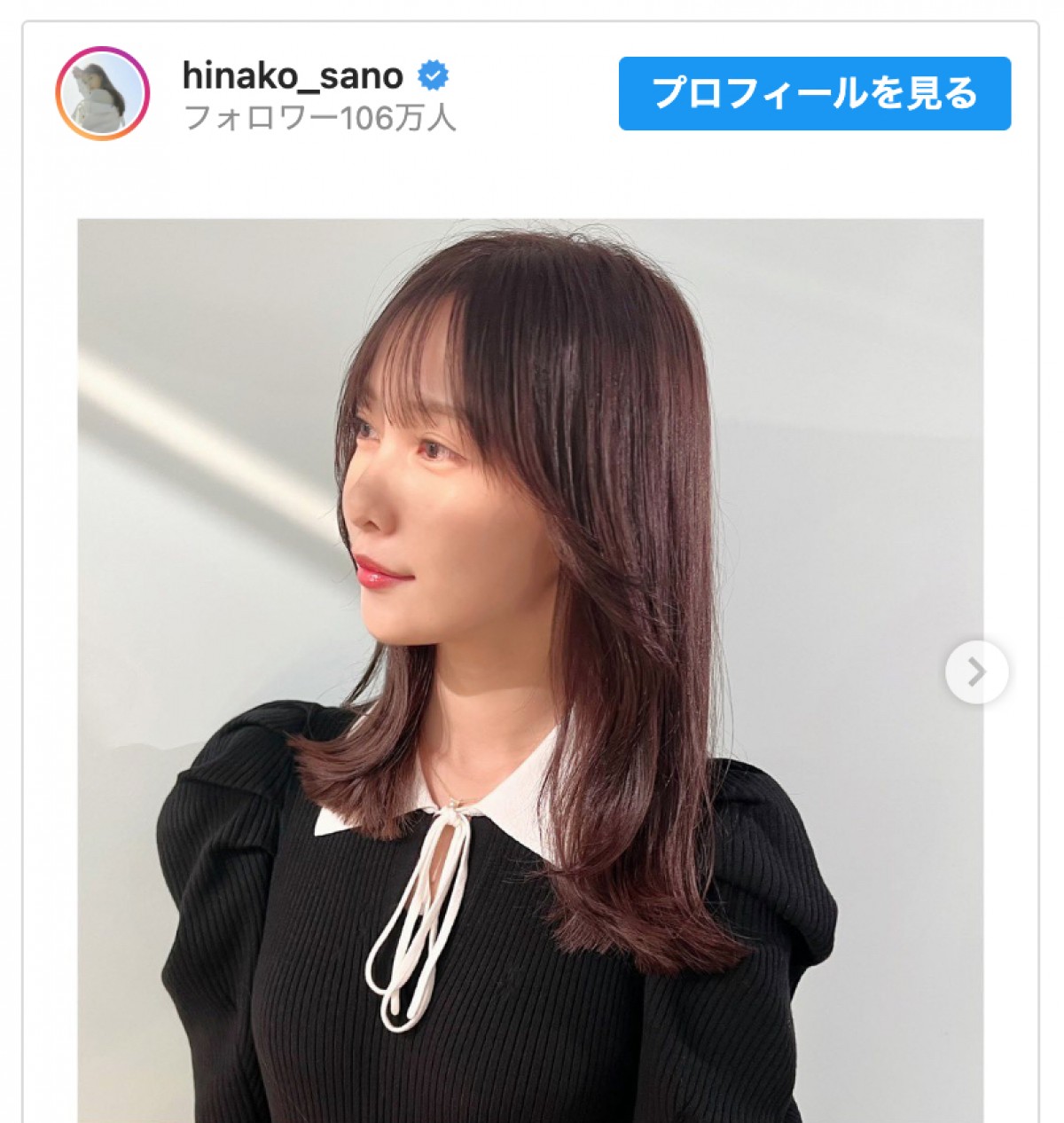 佐野ひなこ、ばっさりヘアカット「ミディアムにした」　「可愛さレベルが高すぎる」と好評