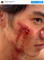 【写真】『キングダム2』山崎賢人リアルな“切り傷”メイク　接写でも「痛そうにみえる」と反響