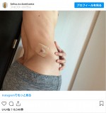 樽美酒研二、「腰を削った」怪我を報告　※「樽美酒研二」インスタグラム