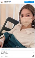声帯ポリープ摘出手術をした大島麻衣 ※「大島麻衣」インスタグラム