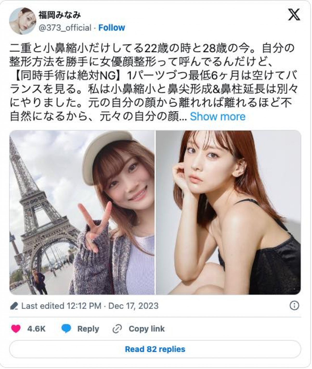 福岡みなみ、顔の整形箇所を公表「私のお顔は全パーツが整形済みです」
