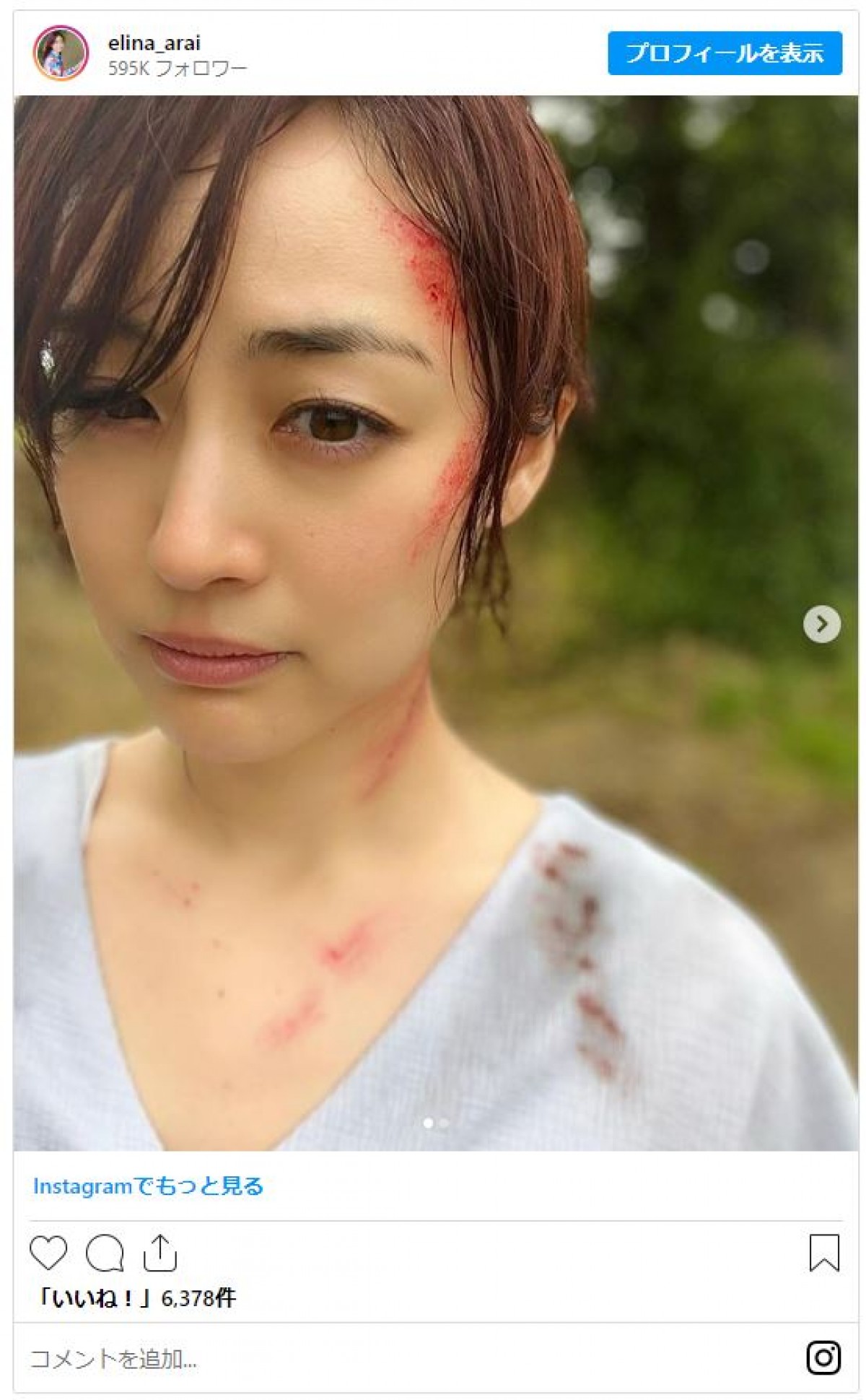 『TOKYO MER』出演の新井恵理那、鈴木亮平からの“泣きの演技の助言”明かす