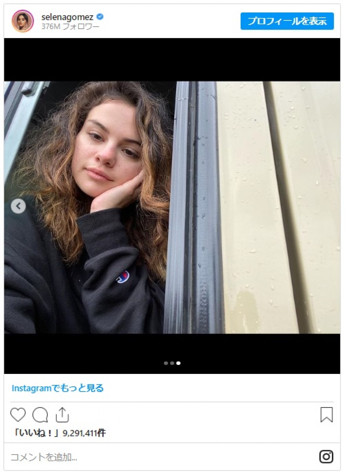 “すっぴん”を投稿したセレーナ・ゴメスをファンが賞賛