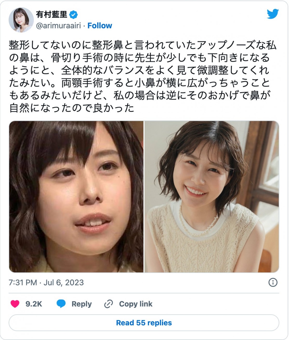有村藍里、整形の理由　妹・有村架純へのコンプレックスではない「劣等感は一切ない」