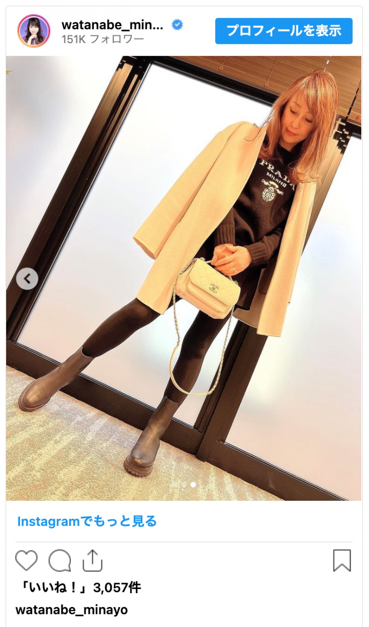 渡辺美奈代、美脚際立つミニ丈パンツコーデに反響「スタイル抜群です」「めちゃくちゃ細い」