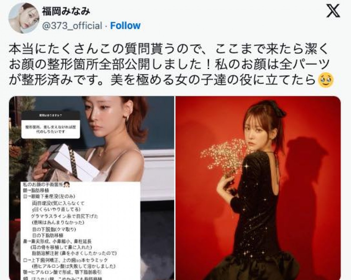 顔の整形箇所を公表した福岡みなみ　※「福岡みなみ」エックス